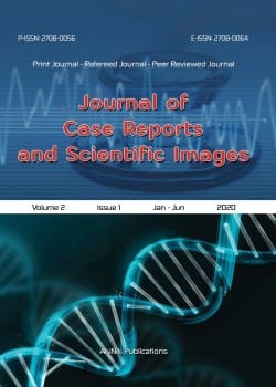 Journal of Case Reports and Scientific Images