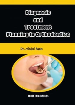 Diagnosis and Treatment Planning in Orthodontics
