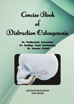 Concise Book of Distraction Osteogenesis