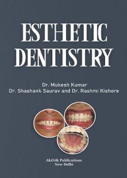 Esthetic Dentistry