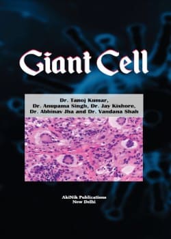 Giant Cell