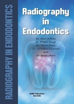 Radiography in Endodontics