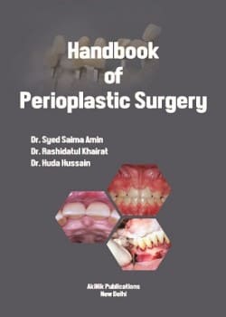 Handbook of Perioplastic Surgery