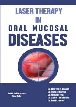 Laser Therapy in Oral Mucosal Diseases