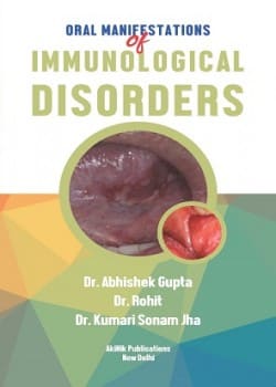 Oral Manifestations of Immunological Disorders