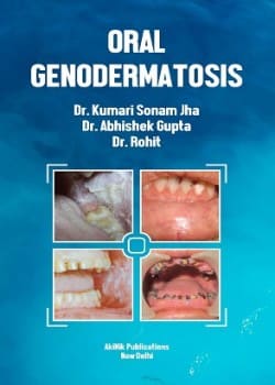 Oral Genodermatosis