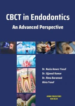 CBCT in Endodontics: An Advanced Perspective