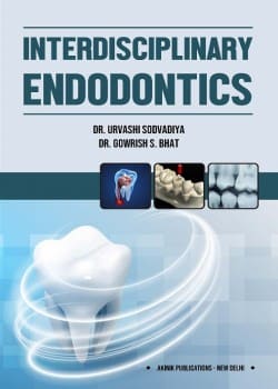 Interdisciplinary Endodontics
