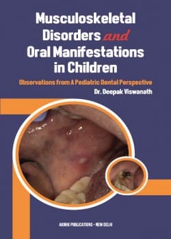 Musculoskeletal Disorders and Oral Manifestations in Children: Observations from A Pediatric Dental Perspective