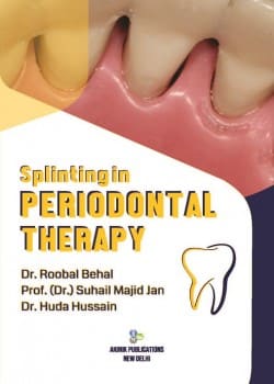 Splinting in Periodontal Therapy