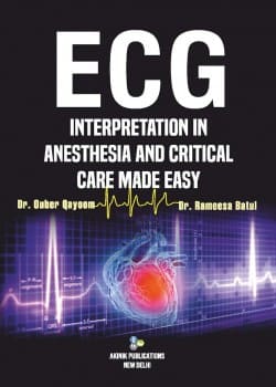 ECG Interpretation in Anesthesia and Critical Care Made Easy