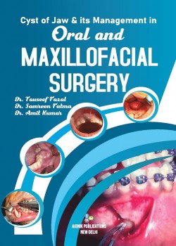 Cyst of Jaw & Its Management in Oral and Maxillofacial Surgery