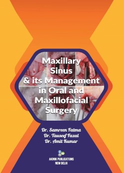Maxillary Sinus & Its Management in Oral and Maxillofacial Surgery