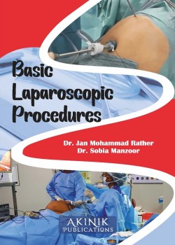 Basic Laparoscopic Procedures