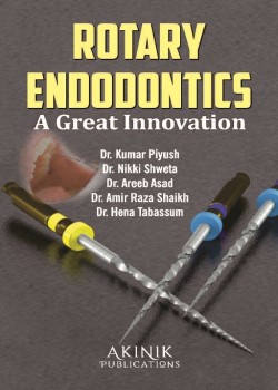 Rotary Endodontics: A Great Innovation