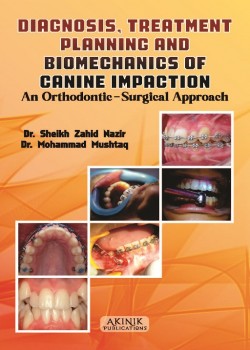 Diagnosis, Treatment Planning and Biomechanics of Canine Impaction: An Orthodontic-Surgical Approach