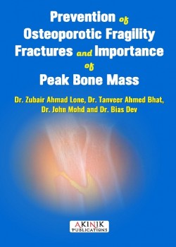 Prevention of Osteoporotic Fragility fractures and Importance of Peak Bone Mass