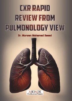 CXR Rapid Review from Pulmonology View