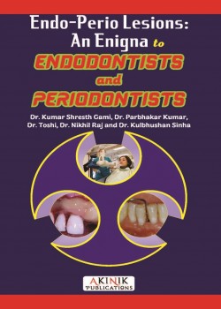 Endo-Perio Lesions: An Enigna to Endodontists and Periodontists