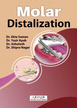 Molar Distalization
