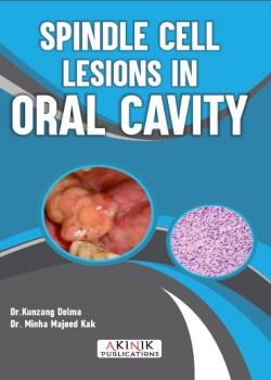 Spindle Cell Lesions in Oral Cavity Spindle Cell Lesions in Oral Cavity