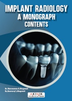 Implant Radiology: A Monograph