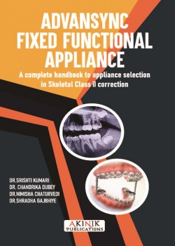 Advansync: Fixed Functional Appliance (A complete handbook to appliance selection in Skeletal Class II correction)