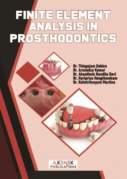 Finite Element Analysis in Prosthodontics