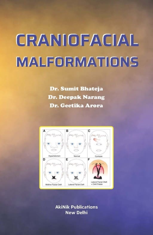 Craniofacial Malformations