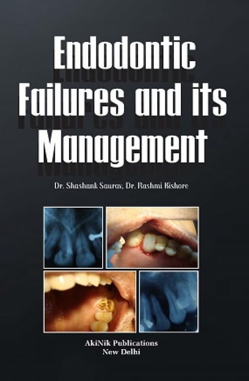 Endodontic Failures and its Management