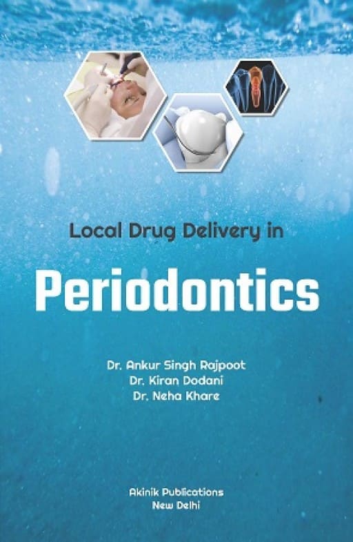 Local Drug Delivery in Periodontics