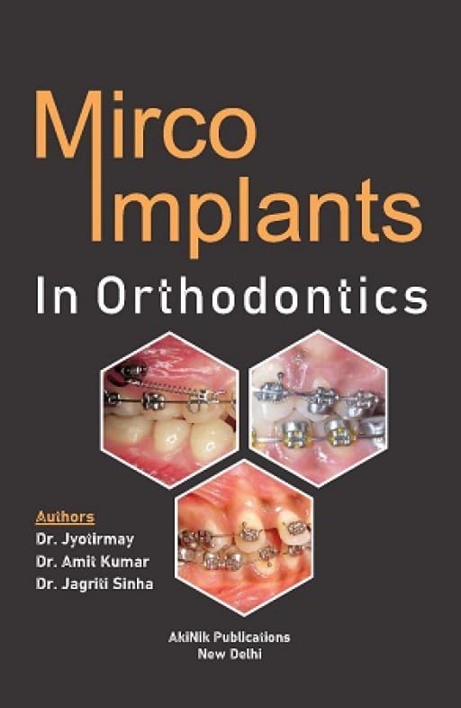 Micro Implants in Orthodontics