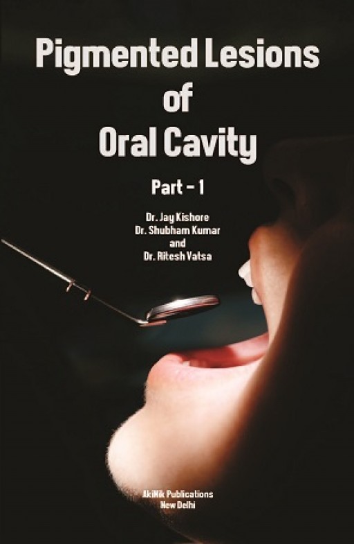 Pigmented Lesions of Oral Cavity (Part - 1)