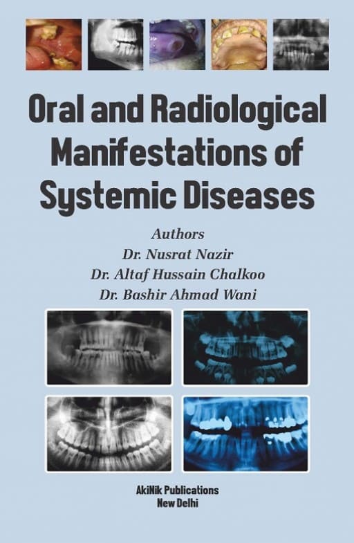 Oral and Radiological Manifestations of Systemic Diseases