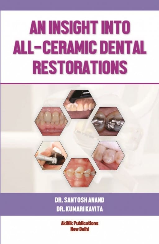 An insight into All-Ceramic Dental Restorations