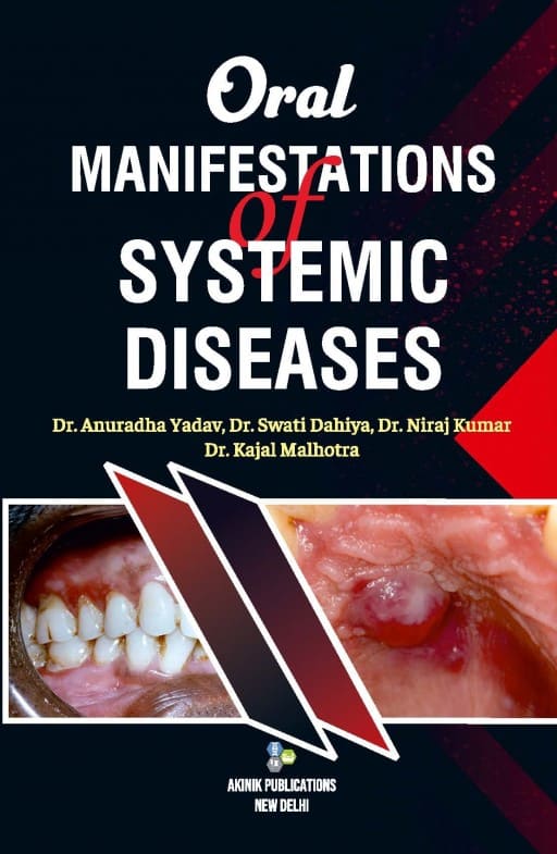 Oral Manifestations of Systemic Diseases