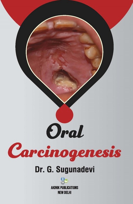 Oral Carcinogenesis