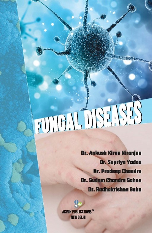 Fungal Diseases
