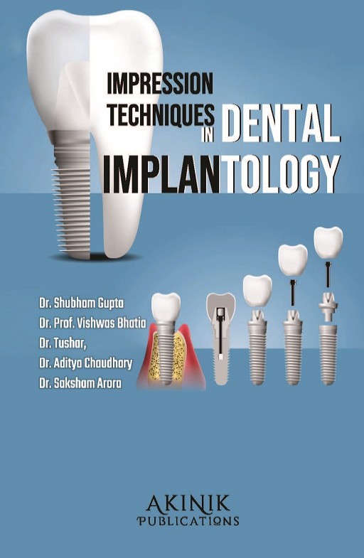 Impression Techniques in Dental Implantology Impression Techniques in Dental Implantology