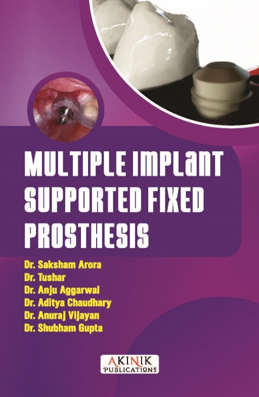 Multiple Implant Supported Fixed Prosthesis