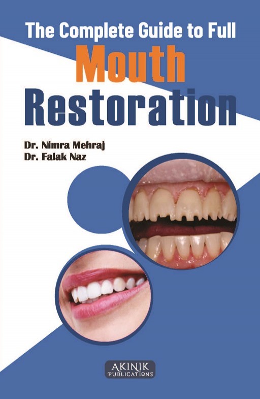 The Complete Guide to Full Mouth Restoration