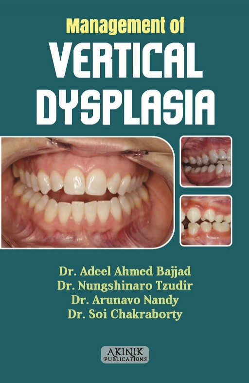 Management of Vertical Dysplasia