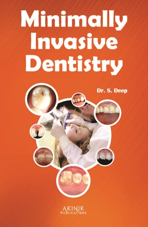 Minimally Invasive Dentistry