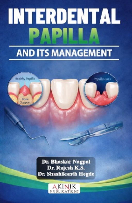 Interdental Papilla and Its Management
