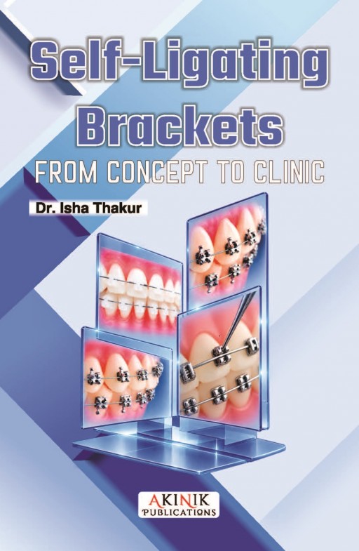 Self-Ligating Brackets: From Concept to Clinic