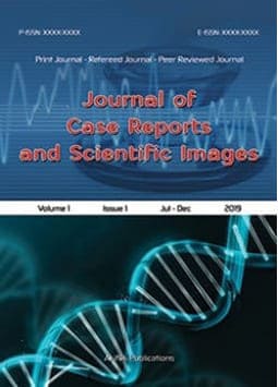 Journal of Case Reports and Scientific Images